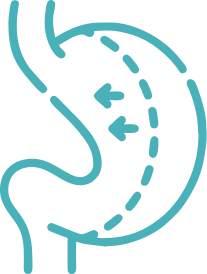 Бариатрическая хирургия